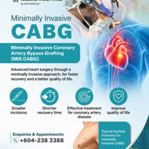 Minimally Invasive CABG